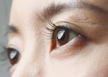 laser eye surgery korea